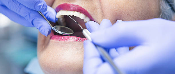 Best Emergency Broken Tooth Repair in Coconut Creek, FL